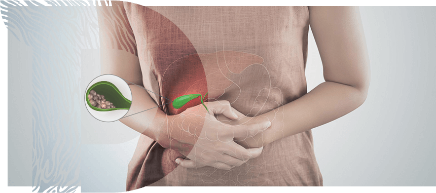 Imagem Litíase da Via Biliar e Pancreatite