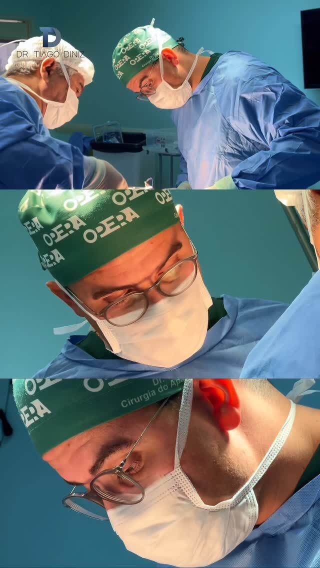 🔹Iniciamos a semana com cirurgia metabólica! Esse procedimento tem se mostrado uma excelente alternativa para o tratamento do diabetes tipo 2 de difícil controle em pacientes com obesidades mais leves. Além de contribuir para o controle glicêmico, a cirurgia metabólica pode proporcionar melhora significativa da qualidade de vida e redução de comorbidades. Minimamente invasiva, segura e com recuperação rápida. #CirurgiaMetabólica #Videolaparoscopia #CirurgiaRobótica #SaúdeDigestiva #DrTiagoDiniz